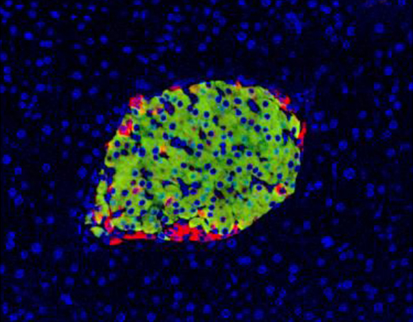 Image of a Pancreatic Islet (Beta Cells are Stained Green). Image Provided by Maria Bettini, Ph.D., from the Laboratory of Dario Vignali, Ph.D., at St. Jude Children's Research Hospital